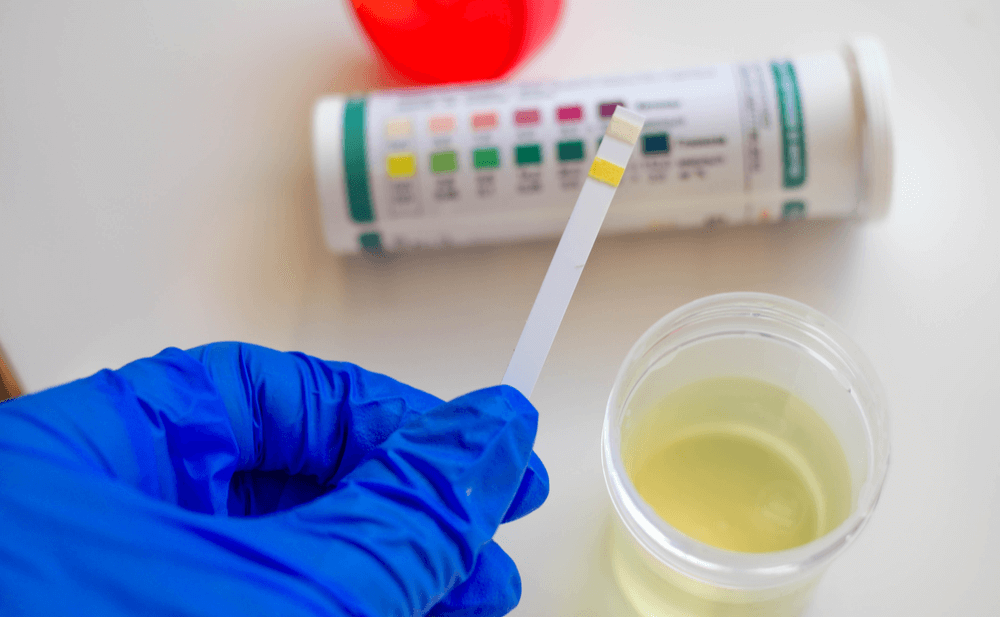 Cómo prevenir y tratar las infecciones urinarias